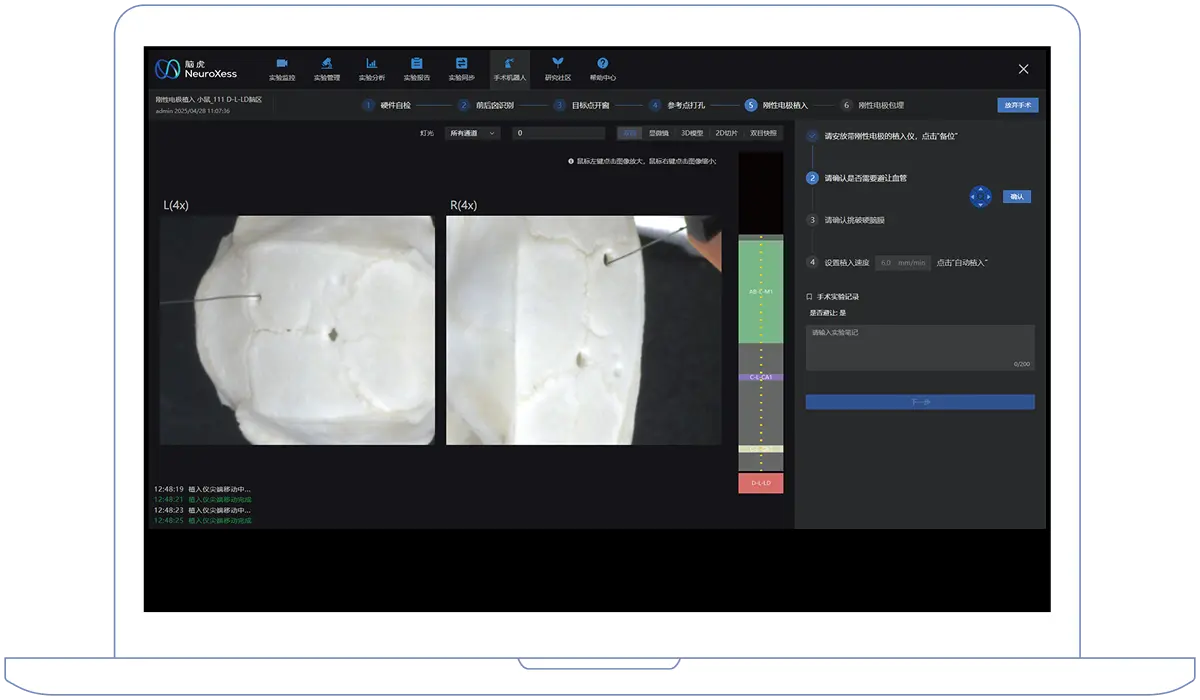 Automatic implantation