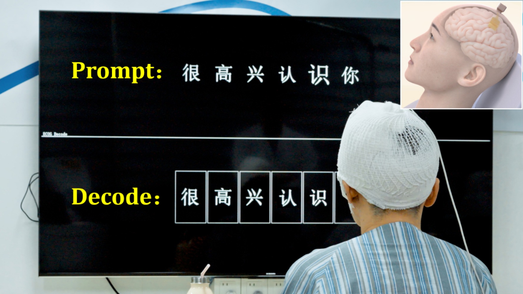 Pioneered the world's first real-time Mandarin speech decoding and synthesis clinical trial